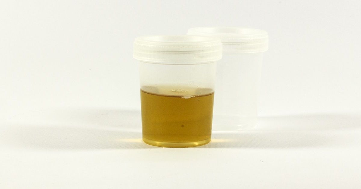 urine test