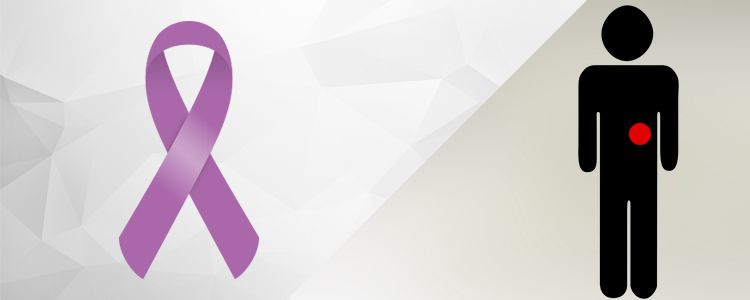 pancreatic cancer