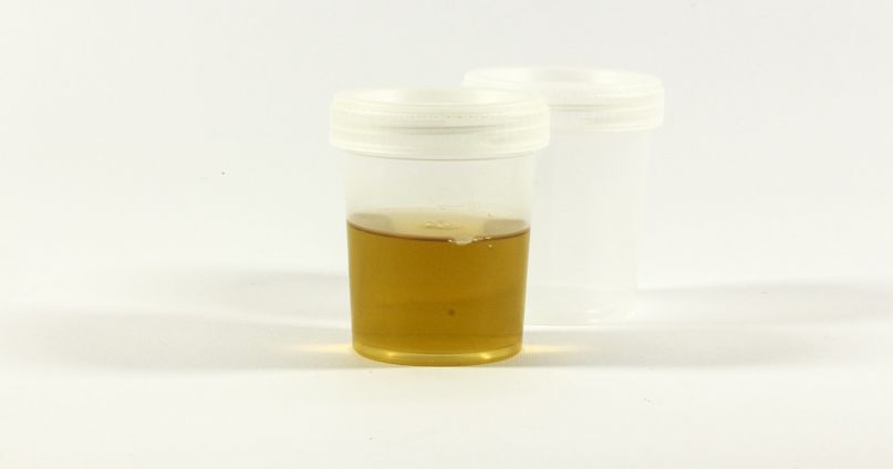 detox from THC - urine test